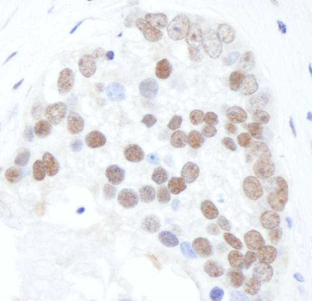 抗Phospho XRCC1 (S518/T519/T523)抗体の使用例画像