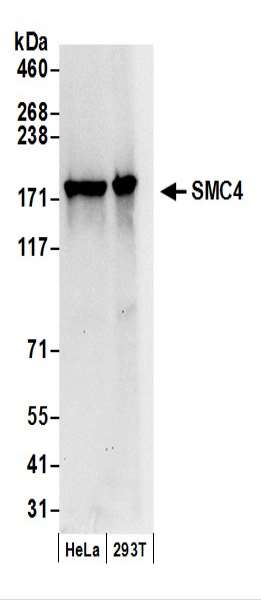 抗SMC4抗体の使用例画像
