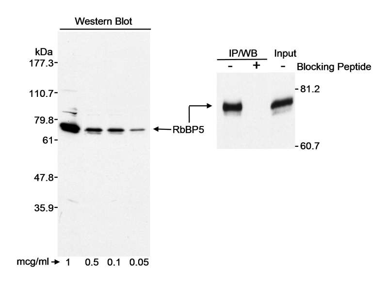 抗RbBP5抗体の使用例画像
