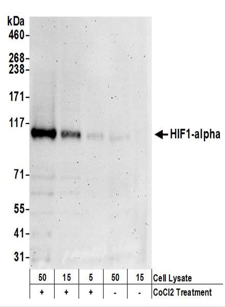 抗HIF1-alpha抗体の使用例画像