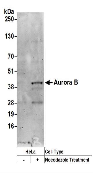 抗Aurora B抗体の使用例画像