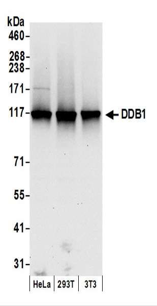 抗DDB1抗体の使用例画像