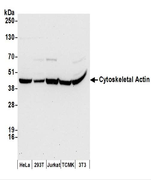 抗Cytoskeletal Actin抗体の使用例画像