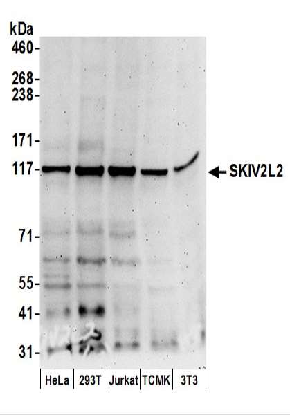 抗SKIV2L2抗体の使用例画像
