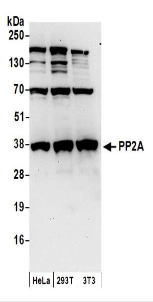抗PP2A抗体の使用例画像