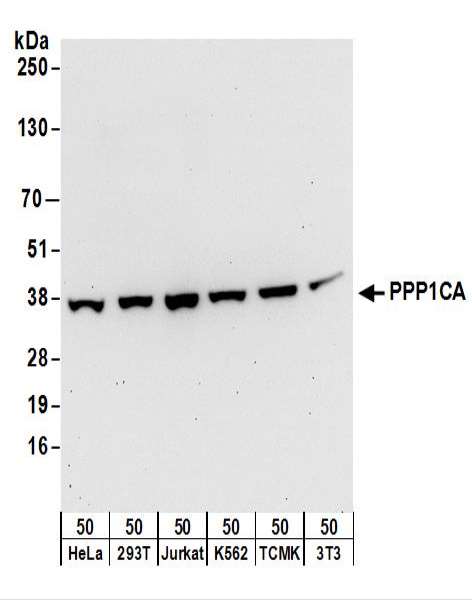 抗PPP1CA抗体の使用例画像