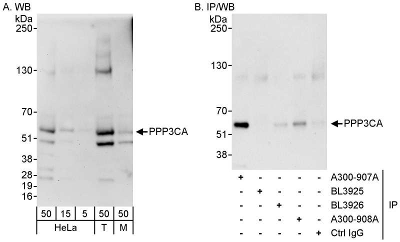 抗PPP3CA抗体の使用例画像