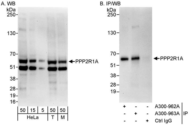 抗PPP2R1A抗体の使用例画像