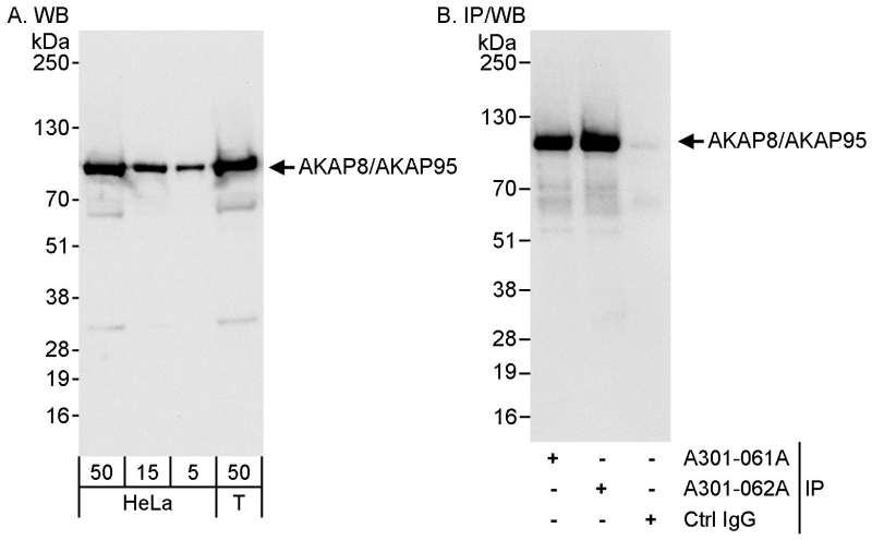 抗AKAP8/AKAP95抗体の使用例画像
