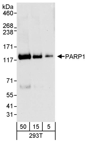 抗PARP1抗体の使用例画像