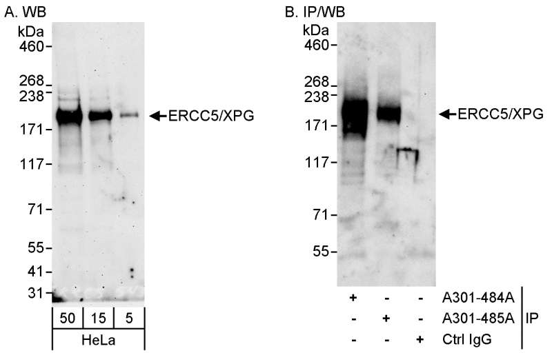 抗ERCC5/XPG抗体の使用例画像