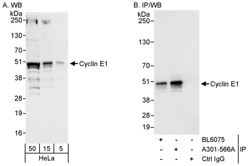 抗Cyclin E1抗体の使用例画像