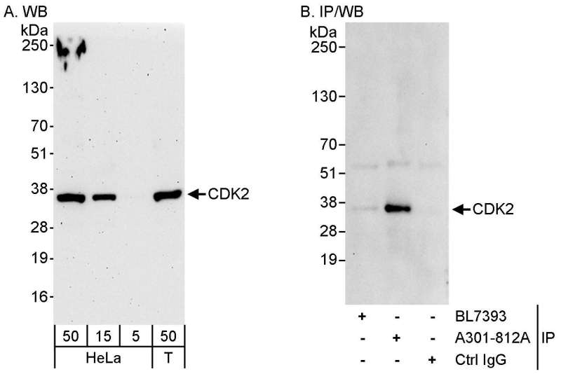 抗CDK2抗体の使用例画像