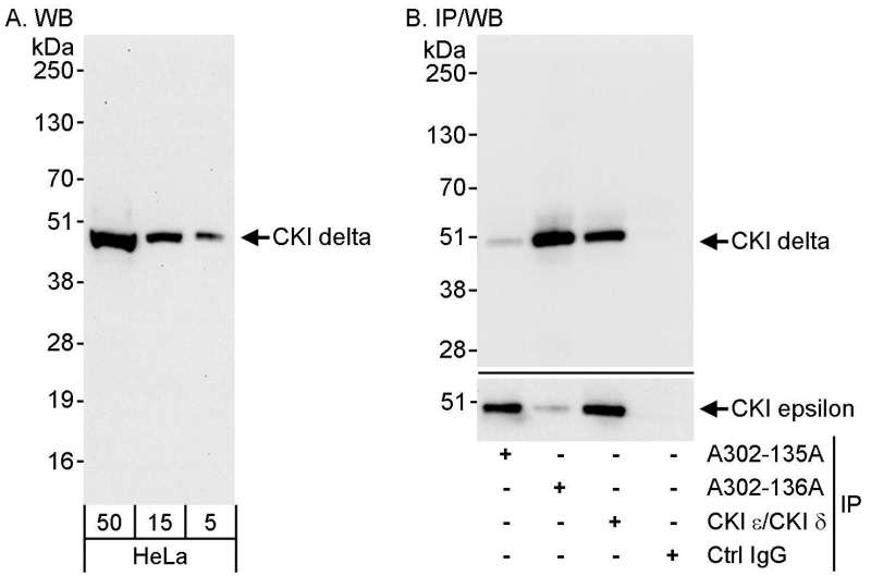 抗CKI delta抗体の使用例画像