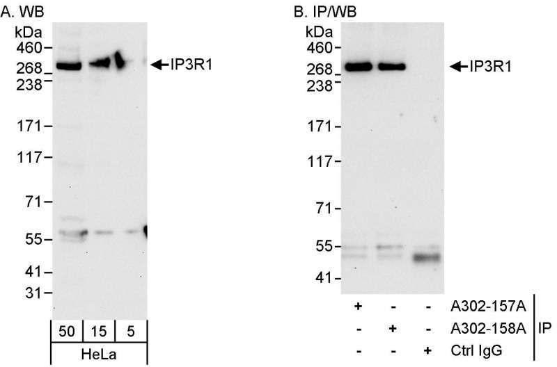 抗IP3R1抗体の使用例画像