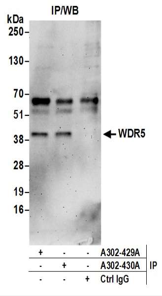 抗WDR5抗体の使用例画像