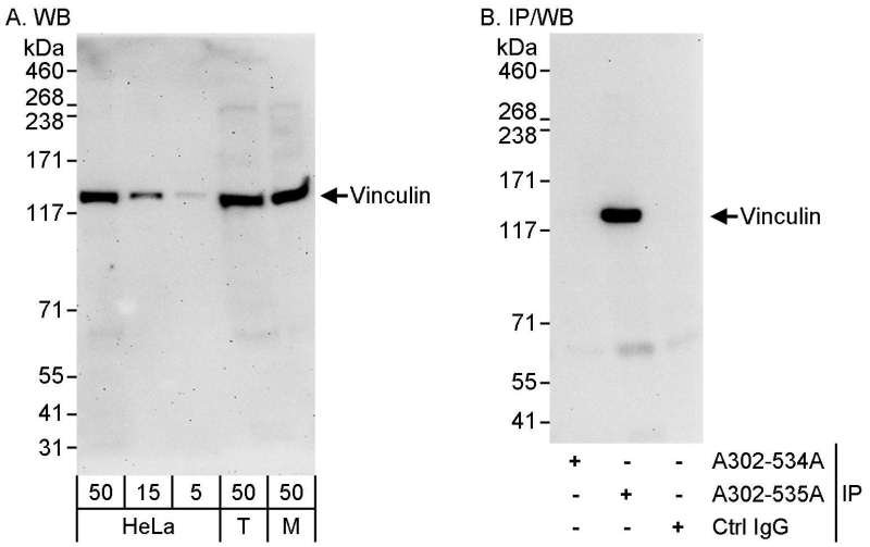 抗Vinculin抗体の使用例画像