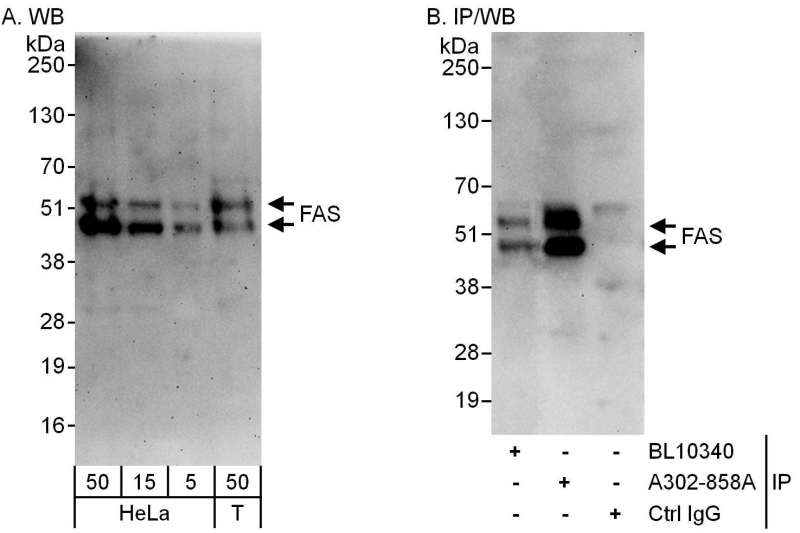 抗FAS抗体の使用例画像