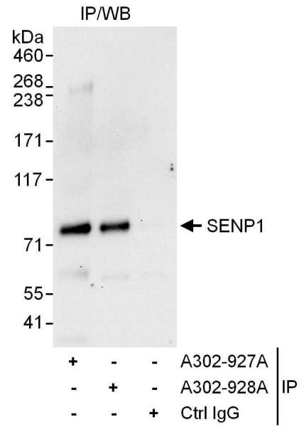 抗SENP1抗体の使用例画像