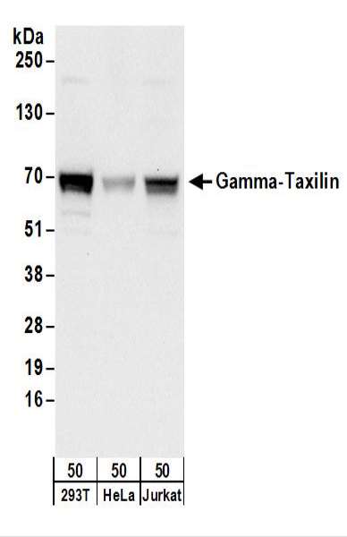 抗Gamma-Taxilin抗体の使用例画像