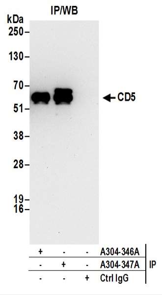 抗CD5抗体の使用例画像