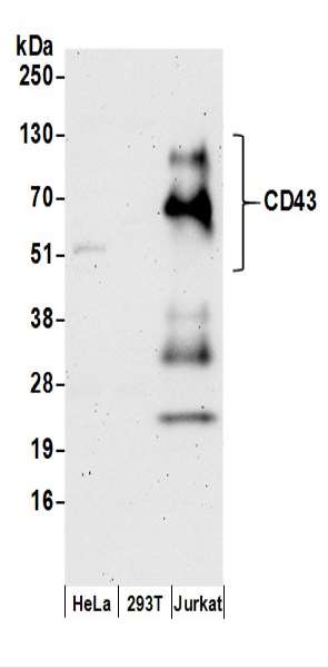 抗CD43抗体の使用例画像