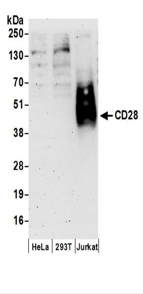 抗CD28抗体の使用例画像