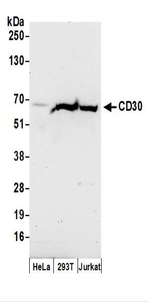 抗CD30抗体の使用例画像