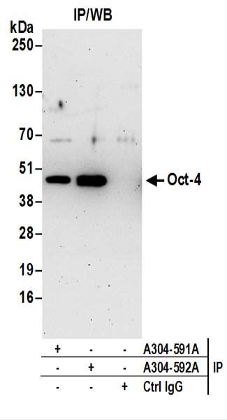 抗Oct-4抗体の使用例画像