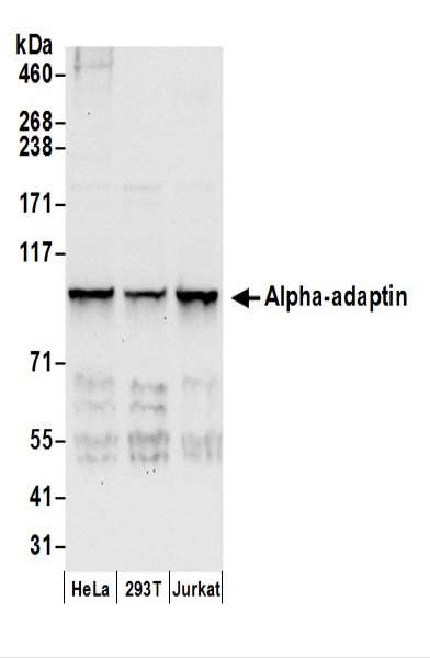 抗Alpha-adaptin抗体の使用例画像