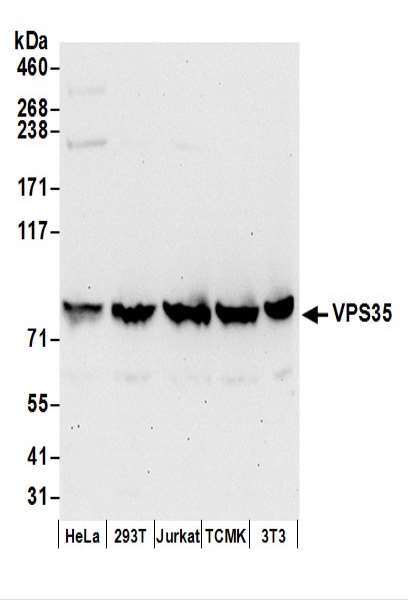 抗VPS35抗体の使用例画像