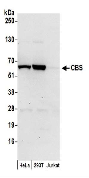 抗CBS抗体の使用例画像