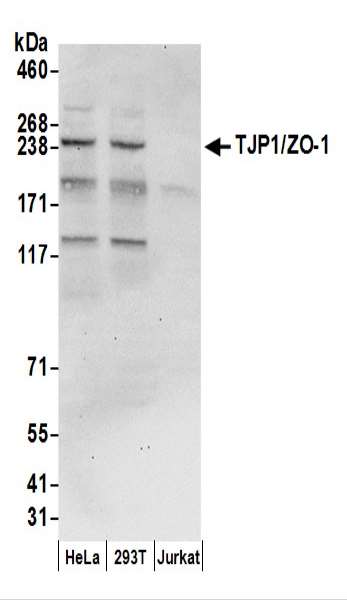 抗TJP1/ZO-1抗体の使用例画像