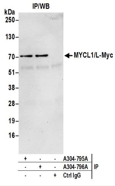抗MYCL1/L-Myc抗体の使用例画像