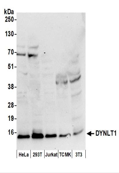抗DYNLT1抗体の使用例画像