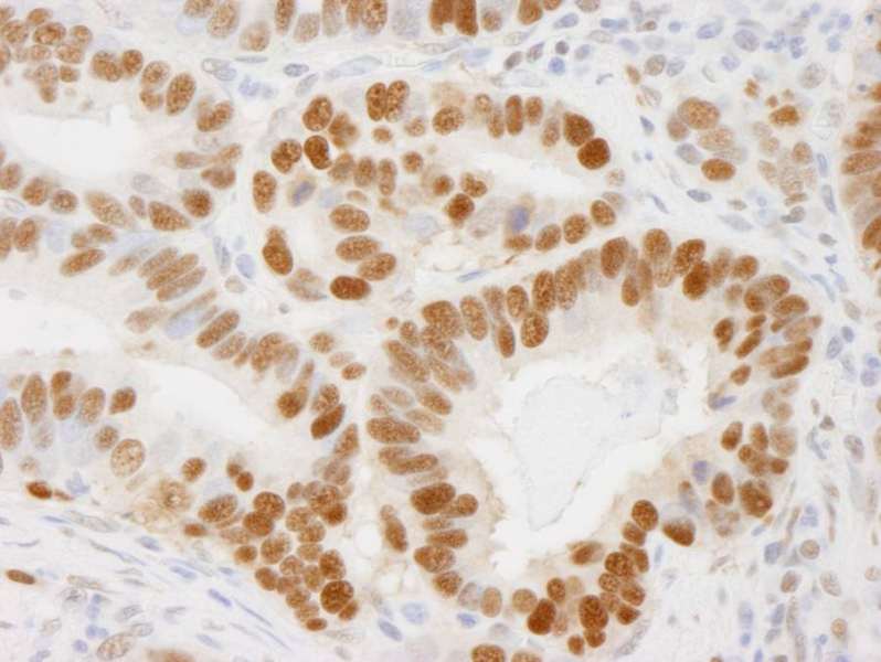 抗PCNA IHC抗体の使用例画像