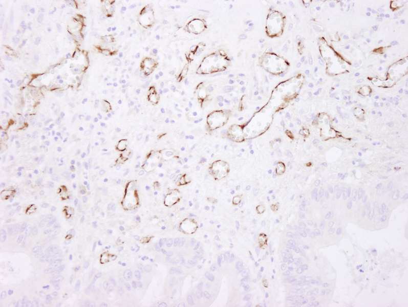 抗CD31 IHC抗体の使用例画像