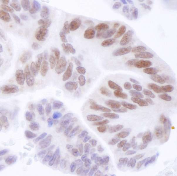 抗ASH2 IHC抗体の使用例画像