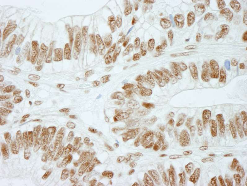 抗RbBP5 IHC抗体の使用例画像