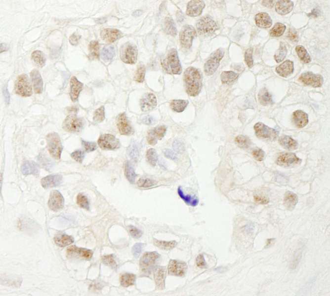 抗FBW7 IHC抗体の使用例画像
