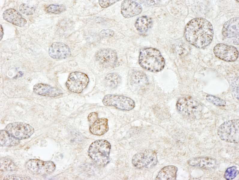 抗NUP50 IHC抗体の使用例画像