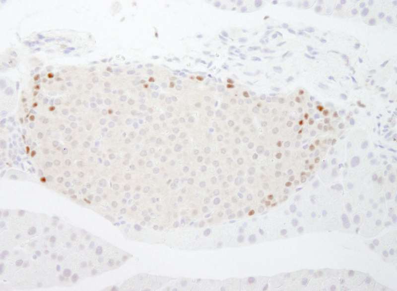 抗MafB IHC抗体の使用例画像