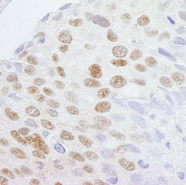 抗ZCCHC8 IHC抗体の使用例画像