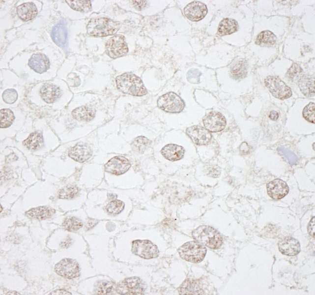 抗DMWD IHC抗体の使用例画像