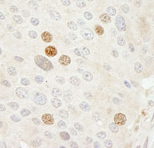抗CDK2 IHC抗体の使用例画像