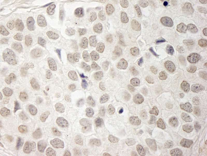 抗PPP1CA IHC抗体の使用例画像