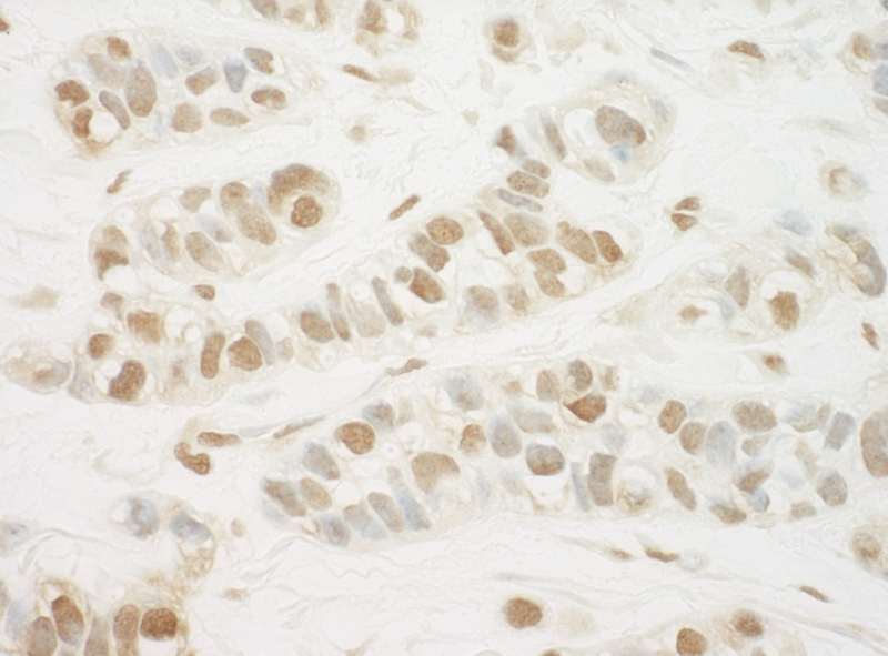 抗MED13L IHC抗体の使用例画像