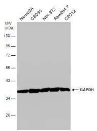Anti-GAPDH antibody (#GTX100118)の使用例