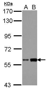 抗DKC1抗体 anti-DKC1 antibodyの使用例2