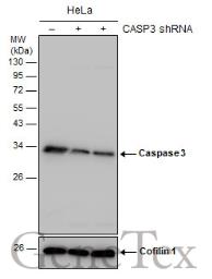 Anti-Caspase 3 antibody (#GTX110543)の使用例